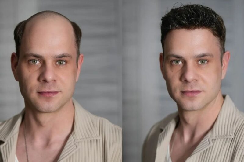 Toupee for Men: A Modern Solution for Natural-Looking Hair Restoration